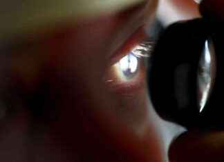 Förväntningar och resultat av ögonoperationer för ålderssynfel – vad man kan förvänta sig news-15092024-212226